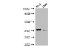 Western Blot<br />
Positive WB detected in:Rosseta bacteria lysate at 40