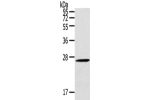 Gel: 10%SDS-PAGE,Lysate: 40 