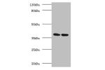 Western blot<br />
All lanes:Antigen 85-A antibody at 2ug/ml<br />
Lane 1 : Recombinant Mycobacterium tuberculosis Antigen 85-A protein 1ug<br />
Lane 2 : Recombinant Mycobacterium tuberculosis Antigen 85-A protein 10ug<br />
Secondary<br />
Goat polyclon