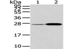Gel: 12%SDS-PAGE, Lysate: 40 