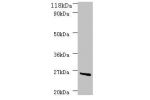 Western blot<br />
All lanes:Purine nucleoside phosphorylase DeoD-type antibody at 2ug/ml+DH5a whole cell lysate<br />
Secondary<br />
Goat polyclonal to Rabbit IgG at 1/10000 dilution<br />
Predicted band size: 26kDa<br />
Observed band size: 26kDa<br />