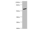 Western blot<br />
All lanes: Glycerol kinase antibody at 2ug/ml+DH5a whole cell lysate<br />
Secondary<br />
Goat polyclonal to rabbit at 1/10000 dilution<br />
Predicted band size: 62kDa<br />
Observed band size: 62kDa<br />