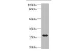 Western blot<br />
All lanes:NAD(P)H-flavin reductase antibody at 2ug/ml+DH5&alpha; whole cell lysate<br />
Secondary<br />
Goat polyclonal to rabbit at 1/10000 dilution<br />
Predicted band size: 26kDa<br />
Observed band size: 26kDa<br />