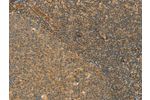 The image on the left is immunohistochemistry of paraffin-embedded Human tonsil tissue using CSB-PA185506(CPA2 Antibody) at dilution 1/40, on the right is treated with fusion protein. (Original magnification: 