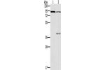 Gel: 6%SDS-PAGE, Lysate: 40 