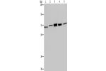 Gel: 6%SDS-PAGE, Lysate: 40 