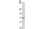 Gel: 6%SDS-PAGE, Lysate: 40 