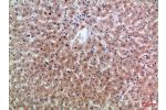 Immunohistochemical analysis of paraffin-embedded Human-liver, antibody was diluted at 1:100