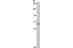 Gel: 8%SDS-PAGE, Lysate: 40 
