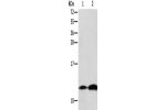 Gel: 15%SDS-PAGE, Lysate: 40 