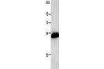 Gel: 10%SDS-PAGE, Lysate: 40 