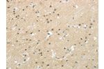 The image on the left is immunohistochemistry of paraffin-embedded Human brain tissue using CSB-PA196402(BAZ1B Antibody) at dilution 1/20, on the right is treated with synthetic peptide. (Original magnification: 