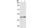Gel: 10%SDS-PAGE, Lysate: 40 
