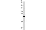 Gel: 10%SDS-PAGE, Lysate: 40 