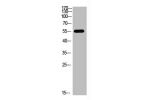Western blot analysis of 3T3 mouse-kidney KB K562 Hela lysate, antibody was diluted at 500. Secondary antibody  was diluted at 1:20000