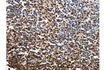 The image on the left is immunohistochemistry of paraffin-embedded Human tonsil tissue using CSB-PA203536(CDO1 Antibody) at dilution 1/40, on the right is treated with fusion protein. (Original magnification: 