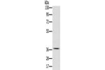 Gel: 8%SDS-PAGE, Lysate: 40 