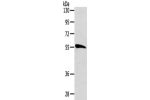 Gel: 8%SDS-PAGE,Lysate: 40 