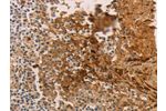 The image on the left is immunohistochemistry of paraffin-embedded Human tonsil tissue using CSB-PA207627(ADCYAP1R1 Antibody) at dilution 1/70, on the right is treated with synthetic peptide. (Original magnification: 