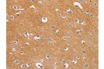 The image on the left is immunohistochemistry of paraffin-embedded Human brain tissue using CSB-PA207957(DUSP10 Antibody) at dilution 1/20, on the right is treated with fusion protein. (Original magnification: 