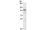 Gel: 6%SDS-PAGE,Lysate: 40 