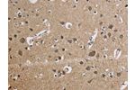 The image is immunohistochemistry of paraffin-embedded Human brain tissue using CSB-PA209356(CYCS Antibody) at dilution 1/50. (Original magnification: 