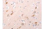 The image on the left is immunohistochemistry of paraffin-embedded Human brain tissue using CSB-PA209818(C1QTNF6 Antibody) at dilution 1/30, on the right is treated with fusion protein. (Original magnification: 
