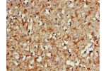 Immunohistochemistry of paraffin-embedded human brain tissue using CSB-PA21109A0Rb at dilution of 1:100