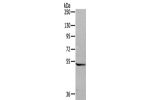 Gel: 6%SDS-PAGE,Lysate: 40 