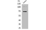 Western Blot analysis of Jurkat cells using Acetyl-Ku-70 (K542) Polyclonal Antibody.