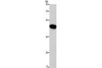 Gel: 10%SDS-PAGE, Lysate: 40 