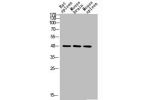 Western blot analysis of RAT-SPLEEN MOUSE-BRAIN MOUSE-SPLEEN lysis using CD72 antibody. Antibody was diluted at 1:2000. Secondary antibody  was diluted at 1:20000