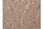 The image on the left is immunohistochemistry of paraffin-embedded Human brain tissue using CSB-PA216811(CLDN23 Antibody) at dilution 1/30, on the right is treated with fusion protein. (Original magnification: 