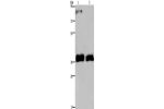 Gel: 8%SDS-PAGE, Lysate: 40 