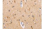 The image on the left is immunohistochemistry of paraffin-embedded Human brain tissue using CSB-PA218040(CTNNA1 Antibody) at dilution 1/15, on the right is treated with fusion protein. (Original magnification: 