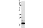 Gel: 12%SDS-PAGE, Lysate: 50 