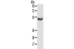 Gel: 8%SDS-PAGE, Lysate: 40 