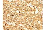 Immunohistochemistry of paraffin-embedded human brain tissue using CSB-PA21939A0Rb at dilution of 1:100