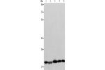 Gel: 8+12%SDS-PAGE, Lysate: 40 