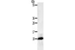 Gel: 10+15%SDS-PAGE, Lysate: 40 