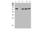 Western Blot analysis of 1,mouse-lung 2,mouse-spleen 3,mouse-kidney 4,mouse-heart 5,293 cells using primary antibody diluted at 1:500(4
