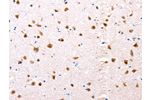 The image on the left is immunohistochemistry of paraffin-embedded Human brain tissue using CSB-PA223323(ESR1 Antibody) at dilution 1/76, on the right is treated with synthetic peptide. (Original magnification: 
