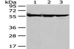Gel: 8%SDS-PAGE, Lysate: 40 
