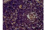 IHC image of CSB-PA22679A0Rb diluted at 1:400 and staining in paraffin-embedded human lymph node tissue performed on a Leica BondTM system. After dewaxing and hydration, antigen retrieval was mediated by high pressure in a citrate buffer (pH 6.0). Section