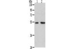 Gel: 10%SDS-PAGE, Lysate: 40 