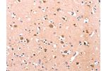 The image on the left is immunohistochemistry of paraffin-embedded Human brain tissue using CSB-PA229389(DUSP12 Antibody) at dilution 1/25, on the right is treated with fusion protein. (Original magnification: 
