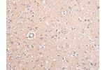 The image on the left is immunohistochemistry of paraffin-embedded Human brain tissue using CSB-PA231151(GJB5 Antibody) at dilution 1/45, on the right is treated with synthetic peptide. (Original magnification: 