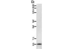 Gel: 12%SDS-PAGE, Lysate: 40 