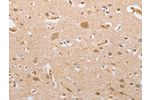 The image on the left is immunohistochemistry of paraffin-embedded Human brain tissue using CSB-PA232532(CSGALNACT2 Antibody) at dilution 1/30, on the right is treated with fusion protein. (Original magnification: 