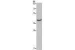 Gel: 10%SDS-PAGE, Lysate: 40 